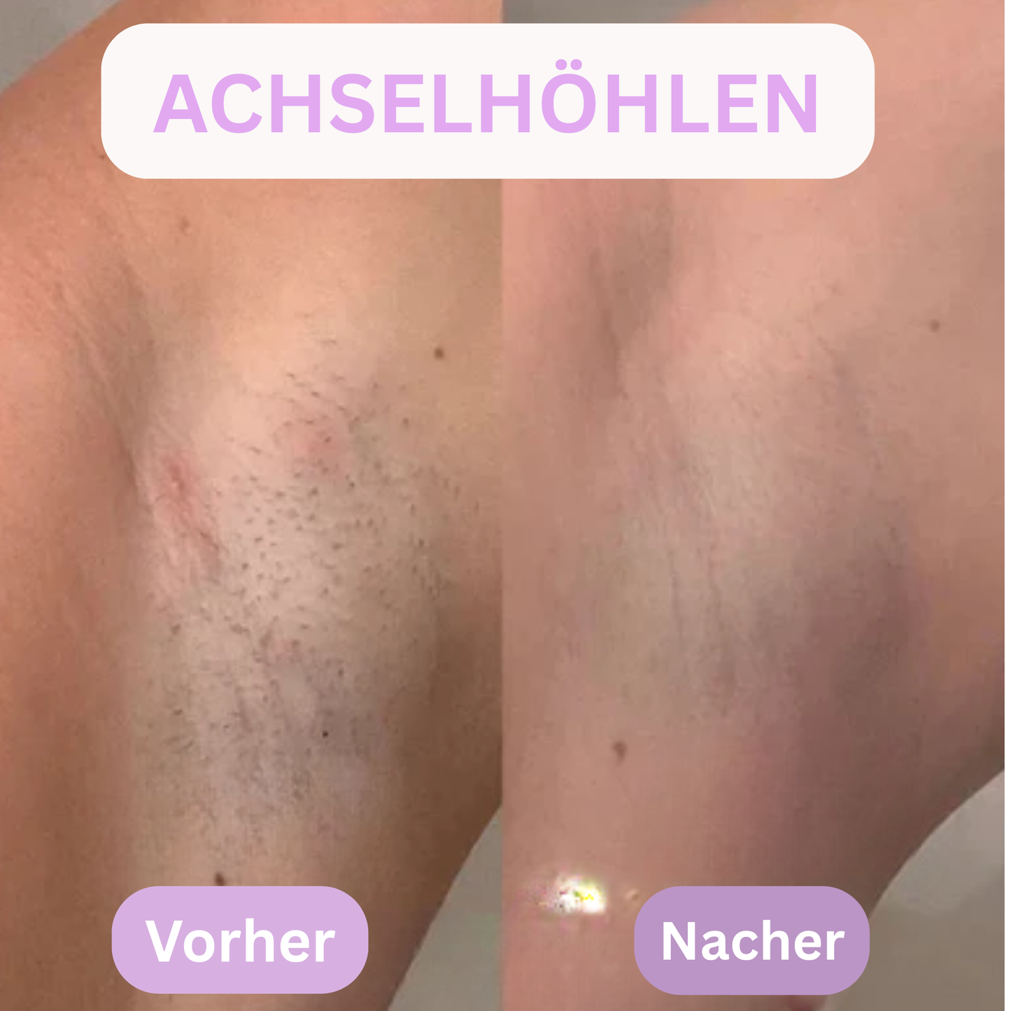 Zaiyna 2-1 Glow Shave